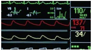 نصب دستگاه مانیتورینگ علایم حیاتی