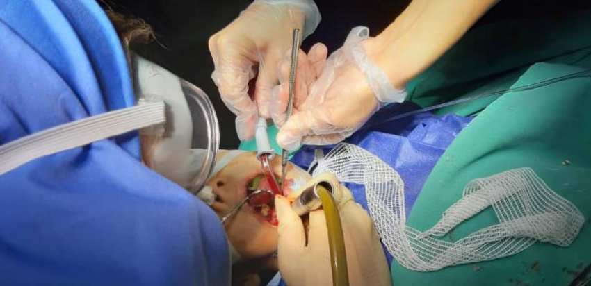 اولین عمل تحت بیهوشی کودکان CP