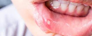 طرح دوره گروه بیماریهای دهان ،فک وصورت