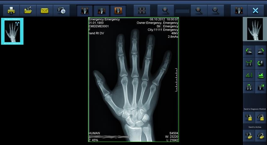 راه اندازی ثبت گزارشات الکترونیکی تصاویر پزشکی در سامانه پکس مرکز درمانی آموزشی امیرکبیر