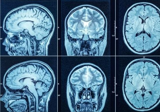 بازدید از مراکز نصب سامانه پکس مدال الکترونیک