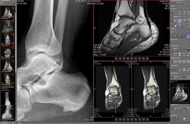 فرمت دایکام در تصاویر پزشکی