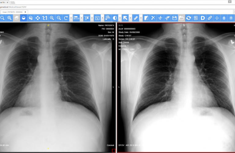 پروتکل نمایش  Hanging