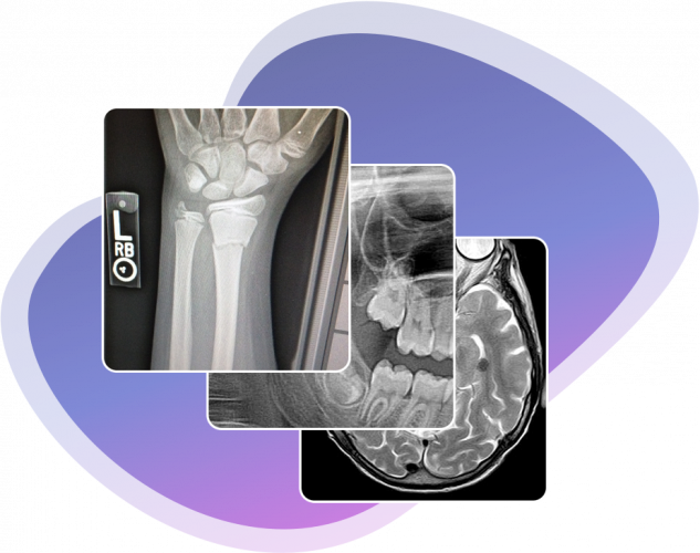 دایپکس  چیست ؟