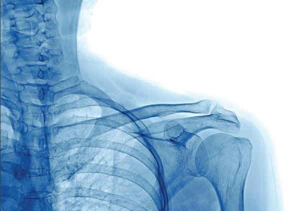 اهمیت سامانه آرشیو و انتقال تصاویر پزشکی