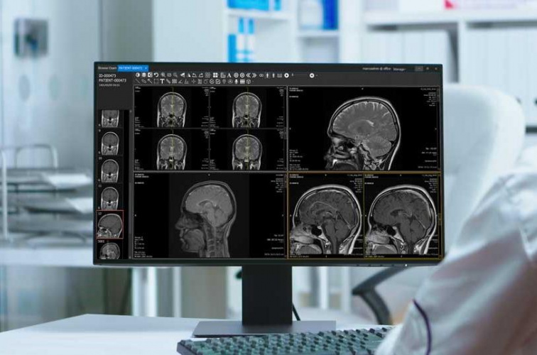 تبدیل تصاویر دو بعدی به تصاویر سه بعدی