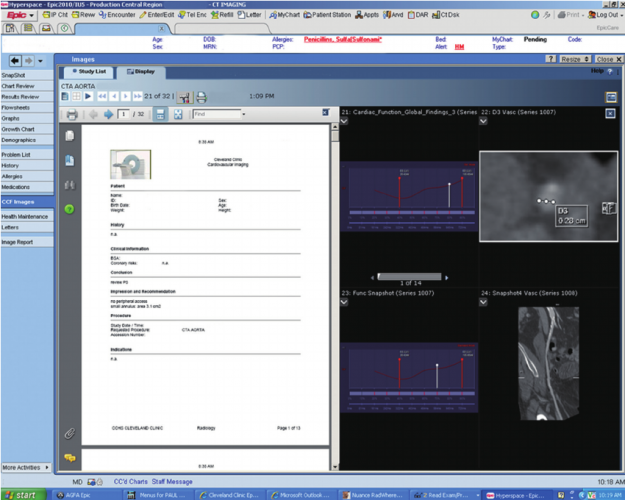 به روز کردن نرم افزار پکس بیمارستان امام خمینی محلات