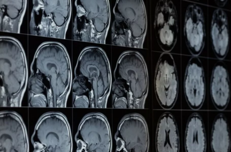 تشخیص سرطان و انواع بیماریها با هوش مصنوعی آسانتر میشود.