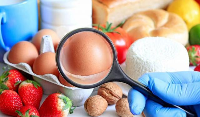 ایمنی و امنیت غذا در ایران