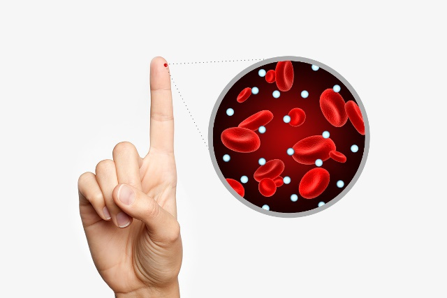 چند علت عجیب مقاومت به انسولین