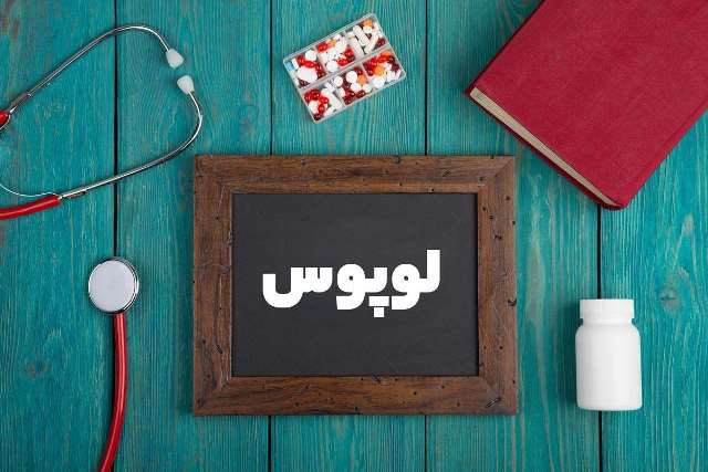 پاسخ به سوالات رایج درباره لوپوس